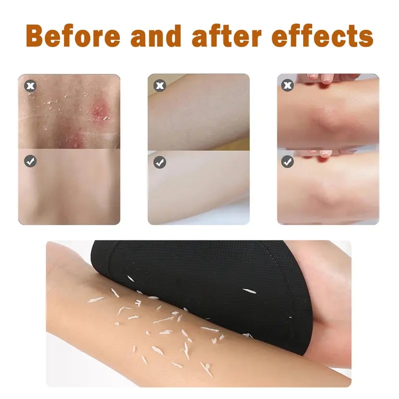 4-Pack Soft Rubber Shower Scrubber – Gentle Yet Effective, Exfoliates & Cleanses All Skin Types